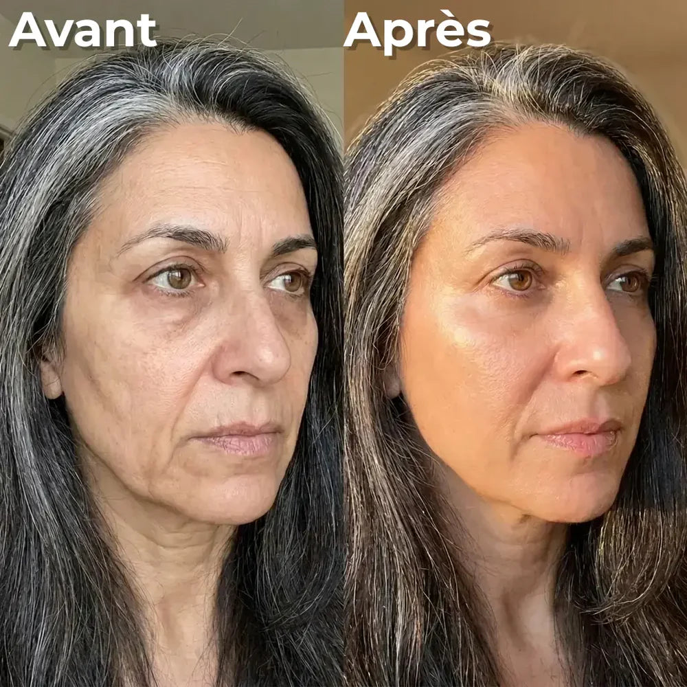 Rétinal shot